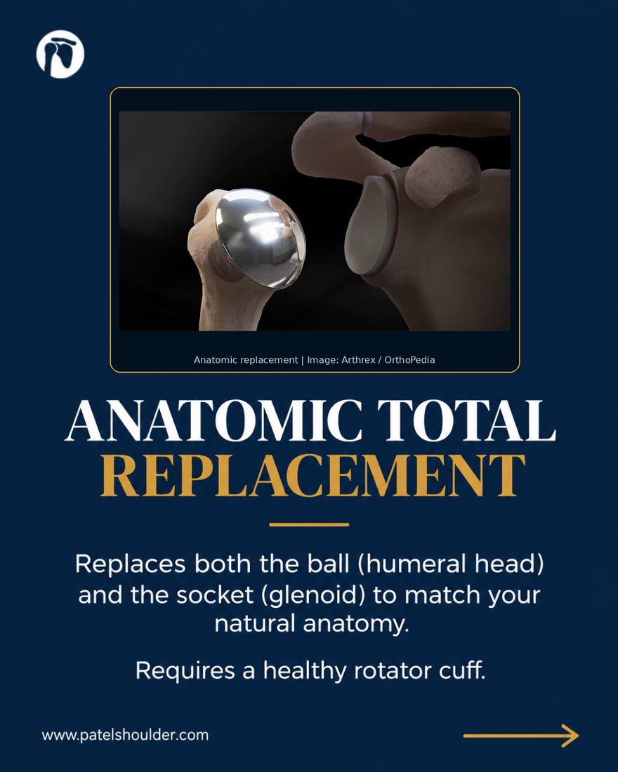 Social post for Dr. Patel explaining anatomic total shoulder replacement